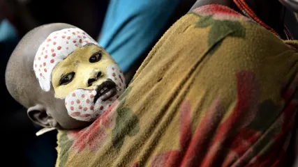 SURMA ETIOPIA DEL SUD